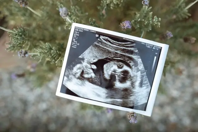 Can a Clinic Destroy Your Frozen Embryos? Georgian Law Explained